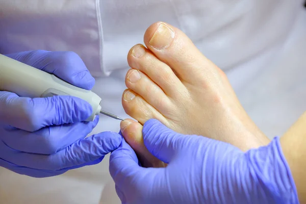 Especialista em pedicure trabalha com o paciente — Fotografia de Stock