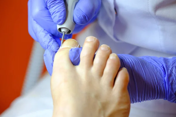 Especialista em pedicure trabalha com o paciente — Fotografia de Stock