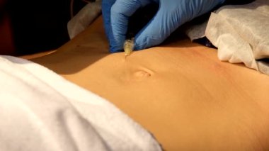 Tıbbi enjeksiyon yordamı cilt