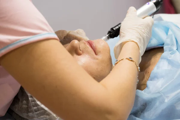 Demonstração de procedimento de cosmetologia em uma clínica — Fotografia de Stock