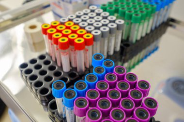 Klinikte bir kanla test tüpleri