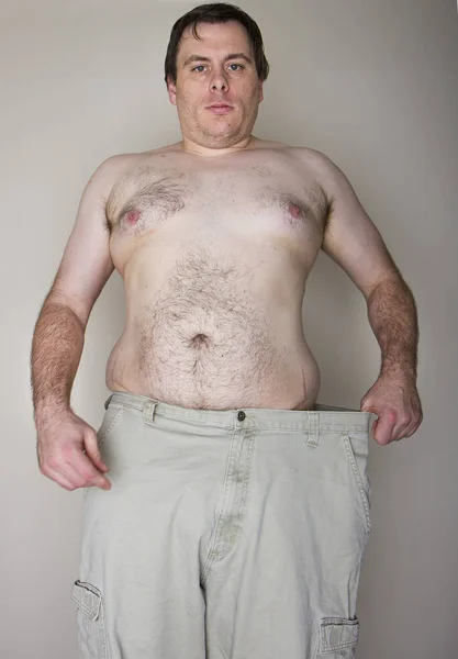 どのくらいの重量を示す側面彼のズボンを保持している太りすぎの男を見失っています — ストック写真