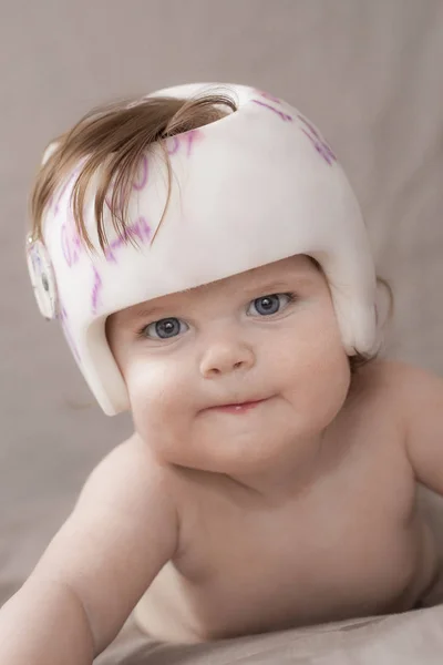 Girl Wearing Her Helmet Treat Plagiocephaly — Stock Photo, Image