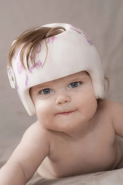 plagiocephaly tedavisi için onu kask giyen kız