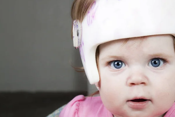 Close Young Girl Wearing Helmet Flat Head Also Known Plagiocephaly — Stock Photo, Image