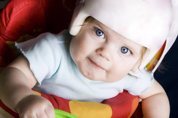 Plagiocephaly ile genç kız etrafında oynarken bir miğfer giyiyor 