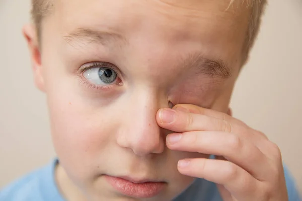 Young child rubbing his eyes with his fingers