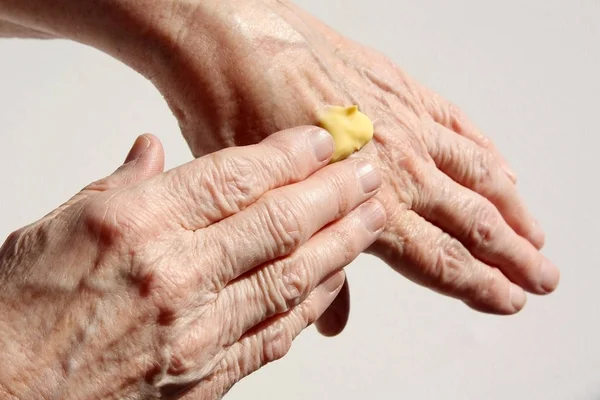 Yaşlı bir kadın ellerine krem sürer.