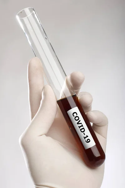 Coronavirus Concept Covid Hand Holding Test Tube Close — Stock Photo, Image