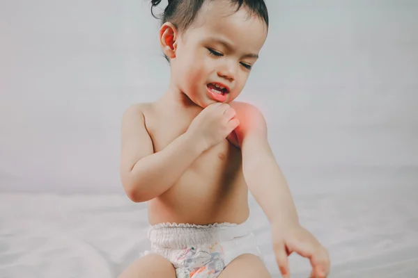 Problème de santé. asiatique petite fille grattant son démangeaison épaule — Photo