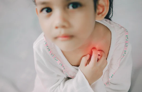 Asiatico giovane ragazza grattare il prurito con mano, collo, prurito, Sanità e Medicina concetto — Foto Stock