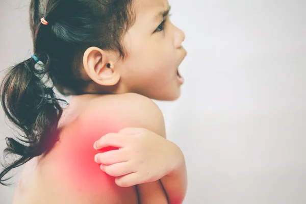 Problema de salud. asiático joven chica rascarse su picazón espalda — Foto de Stock