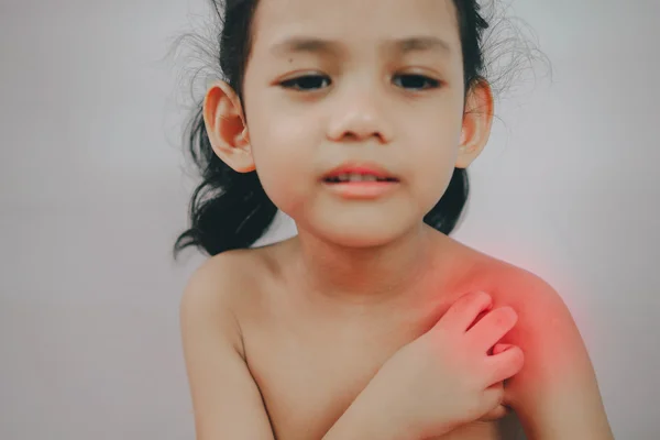 어린 소녀 처음 손, 목, 가려움증 가려움증. — 스톡 사진