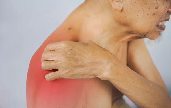 Hombre mayor sosteniendo el hombro en el área del dolor . — Foto de Stock