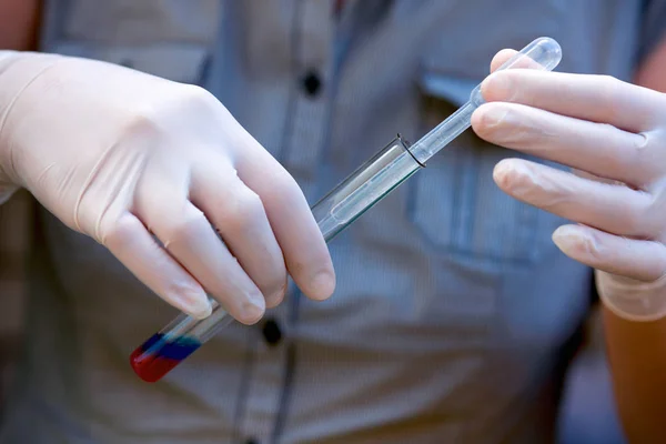 Donna mani in guanti medici facendo prova con provetta e tubo — Foto Stock
