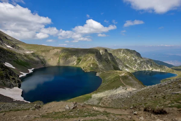 Pemandangan Yang Menakjubkan Dari Mata Dan Danau Kidney Tujuh Danau — Stok Foto