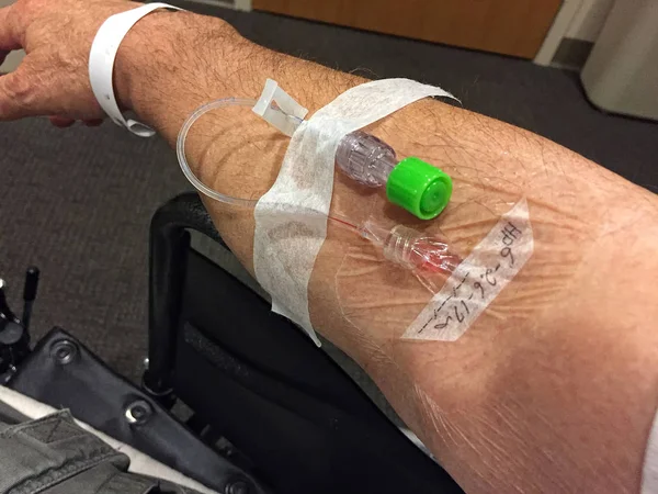Obtendo sangue trabalho através de uma veia — Fotografia de Stock