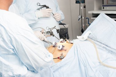 Gastrik bypass cerrahisi