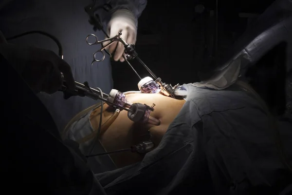 Gastrik bypass cerrahisi