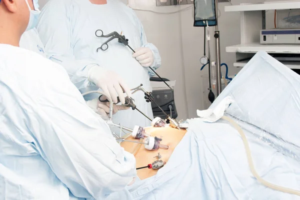 Gastric bypass surgery — Stock Photo, Image