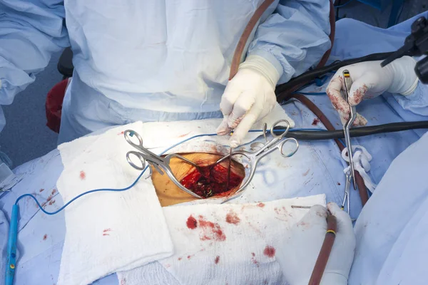 Procedury chirurgiczne — Zdjęcie stockowe
