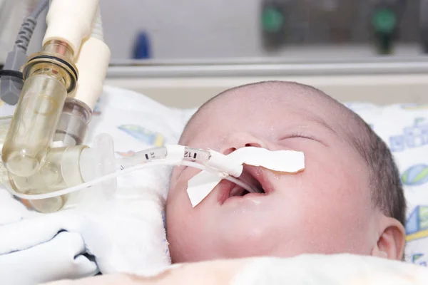Bebé recién nacido dentro de la incubadora — Foto de Stock