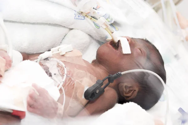 Novorozené dítě uvnitř inkubátoru — Stock fotografie