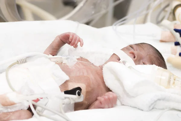 Newborn baby inside incubator — Stock Photo, Image