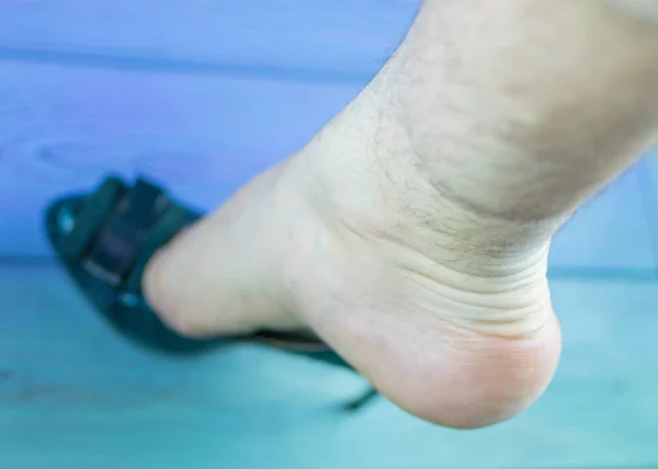 A perna de um homem no sapato de uma mulher com um salto. O conceito de tamanho inadequado do sapato, distúrbios de orientação . — Fotografia de Stock