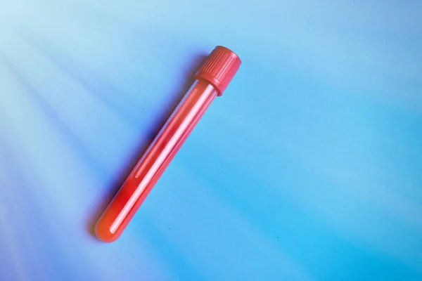 Test Tube Blood Blue Background — Stock Photo, Image