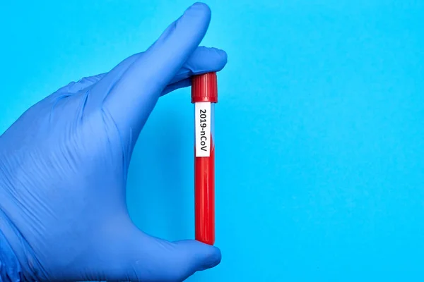 Coronavírus Inscrição Tubo Teste Com Sangue Mão Uma Luva Borracha — Fotografia de Stock