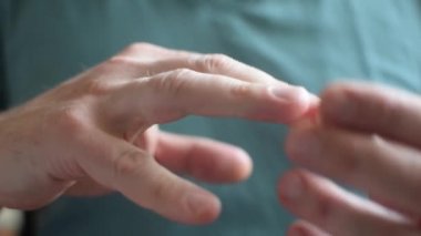 Bir adam alyansını çıkarıyor..