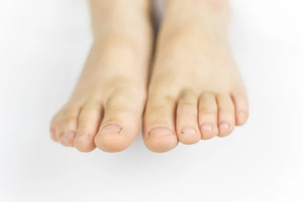 Dirty feet of a little boy\'s feet. Dirt under the fingernails. On a white background.