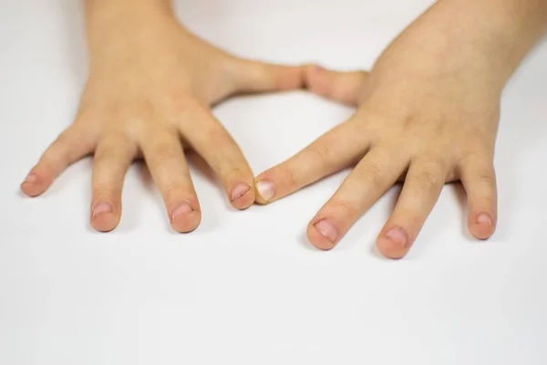 Suciedad Bajo Las Uñas Niño —  Fotos de Stock