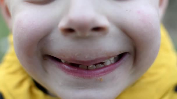 Een Jongen Met Een Vies Gezicht Verloren Tanden Glimlacht — Stockvideo