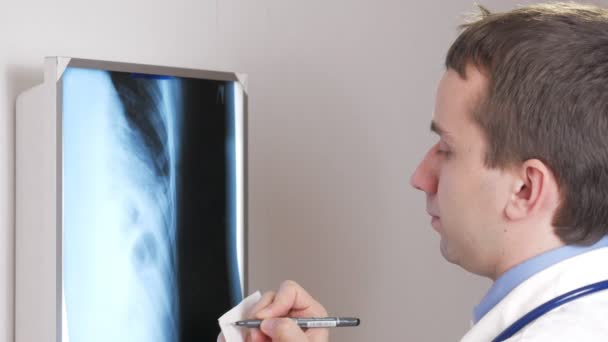 Een jonge dokter schrijft de resultaten van een röntgenfoto van de patiënt met een pen op papier. Röntgenfoto van de ribben. Close-up — Stockvideo