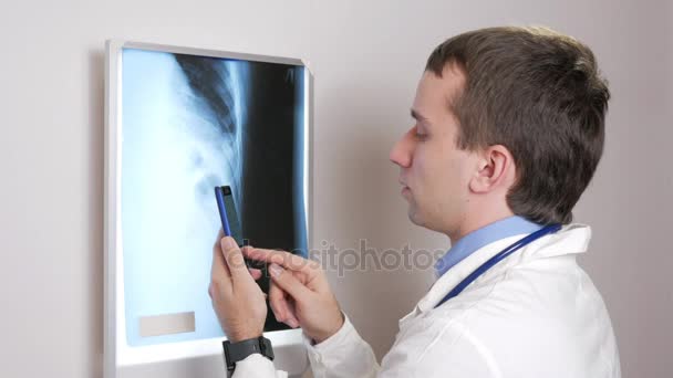 Ein junger Arzt benutzt ein Telefon in der Klinik. Ein Mann zeichnet die Ergebnisse einer Röntgenaufnahme des Patienten auf. — Stockvideo