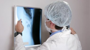 Genç bir Doktor duvardaki bir hasta röntgen sonuçlarını inceler. Toraks ve kaburga analiz eder.