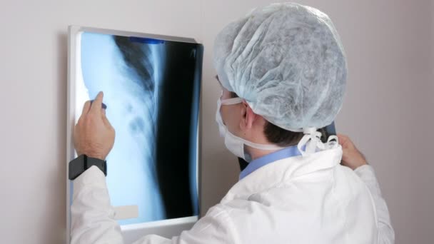 Genç bir Doktor duvardaki bir hasta röntgen sonuçlarını inceler. Toraks ve kaburga analiz eder. — Stok video