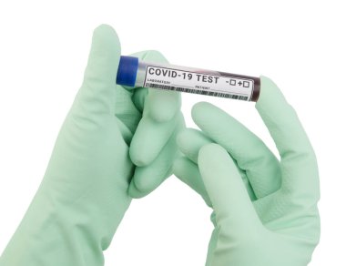 Eldivenli eller, üzerinde koronavirüs testi için kan örneği olan bir test tüpü tutuyor. Beyaz arkaplanda izole.