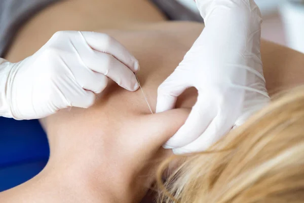 Young physiotherapist doing a trigger point injection in patient back. — Stock Photo, Image