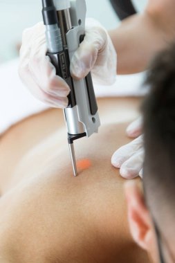 Güzellik Uzmanı'nın elleri ile bir lazer Güzellik Salonu onu istemciye geri saç kaldırma.