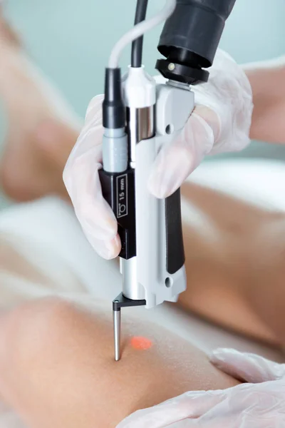 Kosmetyczka ręce usuwania włosów na nogach laserem do jej klienta w salonie piękności. — Zdjęcie stockowe