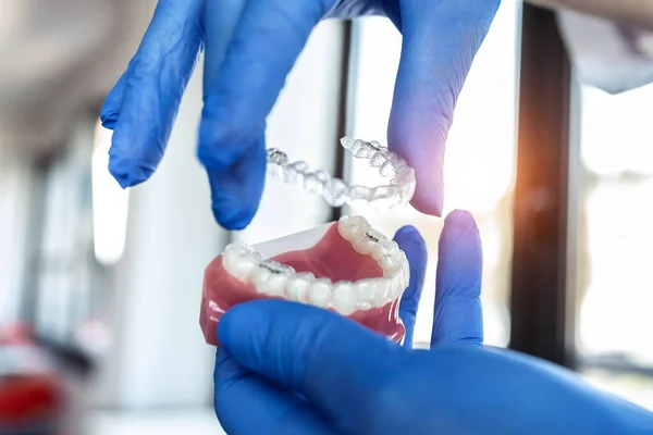 Doktorların Yakın Plan Çekimleri Mavi Eldivenler Içinde Görünmeyen Diş Telleri — Stok fotoğraf