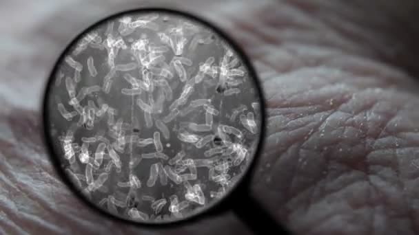 Поиск вируса на коже человека — стоковое видео