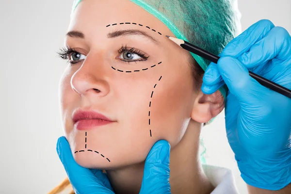Хирург рисует перфорационные линии на лице женщины — стоковое фото