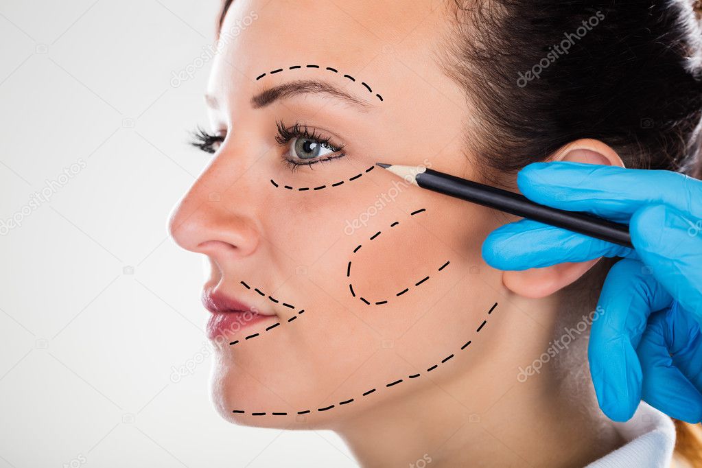 Surgeon Drawing Correction Lines On Young Woman Face