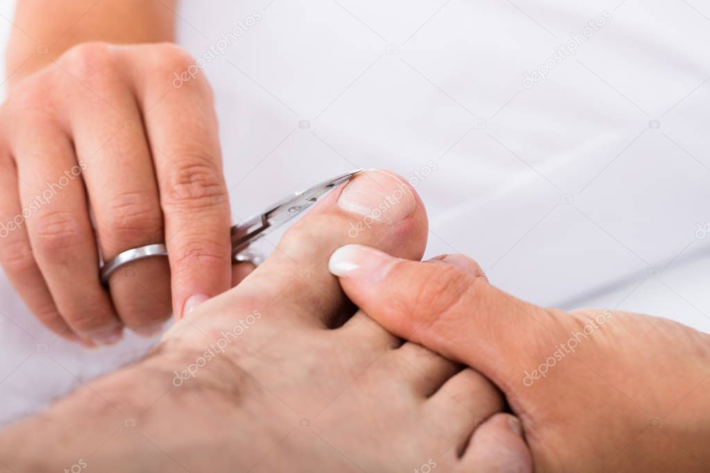 мужские ногти на ногах