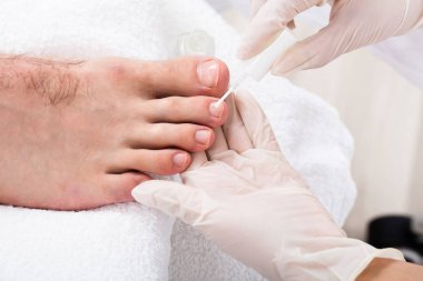 Manicurist applying treatment on Male Toenails  clipart