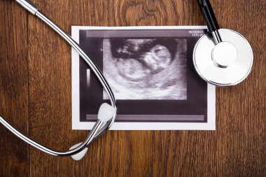 Stetoskop ultrason üstünde okul sırası ile